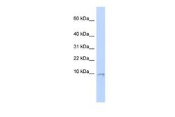 Invitrogen UCRC Polyclonal Antibody 100 &mu;L; Unconjugated:Antibodies,