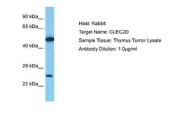 Invitrogen CLEC2D Polyclonal Antibody 100 &mu;L; Unconjugated:Antibodies,