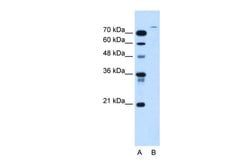 Invitrogen USP48 Polyclonal Antibody 100 &mu;L | Buy Online | Invitrogen&trade; | Fisher Scientific