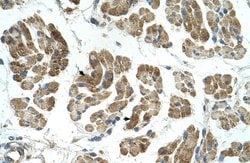 Invitrogen RHOT1 Polyclonal Antibody 100 &mu;L; Unconjugated:Antibodies,