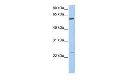 Invitrogen FAM3C Polyclonal Antibody 100 &mu;L; Unconjugated:Anticuerpos