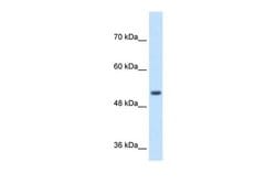 SPPL2B Polyclonal Antibody:Antibodies, Polyclonal