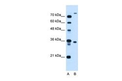 Invitrogen TMEM231 Polyclonal Antibody 100 &mu;L; Unconjugated:Antibodies,