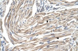 MGST2 Polyclonal Antibody:Antibodies, Polyclonal