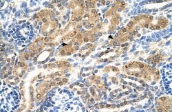 PTPN2 Polyclonal Antibody, Invitrogen 100 &mu;L; Unconjugated:Antibodies,