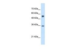 Invitrogen TRAP alpha Polyclonal Antibody 100 &mu;L | Buy Online | Invitrogen&trade; | Fisher Scientific