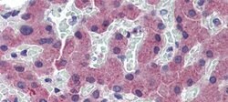 Invitrogen TFR2 Polyclonal Antibody 100 &mu;L; Unconjugated:Antibodies,