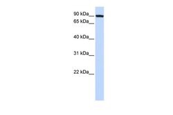 Invitrogen TFR2 Polyclonal Antibody 100 &mu;L; Unconjugated:Antibodies,