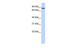 Invitrogen TFR2 Polyclonal Antibody 100 &mu;L | Buy Online | Invitrogen&trade; | Fisher Scientific