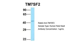 Invitrogen TM7SF2 Polyclonal Antibody 100 &mu;L; Unconjugated:Antibodies,