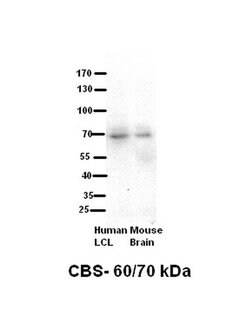 Invitrogen CBS Polyclonal Antibody 100 &mu;L; Unconjugated:Antibodies,