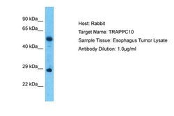 Invitrogen TRAPPC10 Polyclonal Antibody 100 &mu;L; Unconjugated:Antibodies,