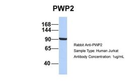 Invitrogen PWP2 Polyclonal Antibody 100 &mu;L; Unconjugated:Antibodies,