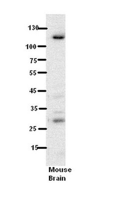 N6AMT1 Polyclonal Antibody:Antibodies, Polyclonal