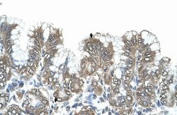 Invitrogen SIK1 Polyclonal Antibody 100 &mu;L; Unconjugated:Antibodies,