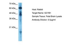Invitrogen GUCY1B3 Polyclonal Antibody 100 &mu;L; Unconjugated:Antibodies,