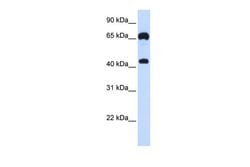 Invitrogen GUCY1B3 Polyclonal Antibody 100 &mu;L; Unconjugated:Antibodies,