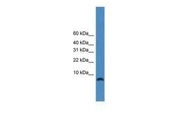 Invitrogen&trade;&nbsp;KIAA0101 Polyclonal Antibody