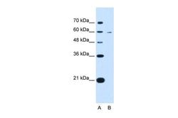 Invitrogen KYNU Polyclonal Antibody 100 &mu;L; Unconjugated:Antibodies,