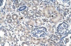 Invitrogen PPAT Polyclonal Antibody 100 &mu;L; Unconjugated:Antibodies,
