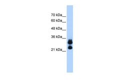 Invitrogen Histone H1.2 Polyclonal Antibody 100 &mu;L; Unconjugated:Antibodies,