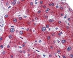 Invitrogen MTHFD1 Polyclonal Antibody 100 &mu;L | Buy Online | Invitrogen&trade; | Fisher Scientific