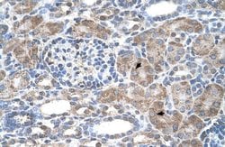 Invitrogen IFI44L Polyclonal Antibody 100 &mu;L; Unconjugated:Antibodies,