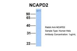 Invitrogen NCAPD2 Polyclonal Antibody 100 &mu;L | Buy Online | Invitrogen&trade; | Fisher Scientific