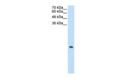 Invitrogen MRPS12 Polyclonal Antibody 100 &mu;L; Unconjugated:Antibodies,