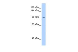 Invitrogen OSMR Polyclonal Antibody 100 &mu;L | Buy Online | Invitrogen&trade; | Fisher Scientific