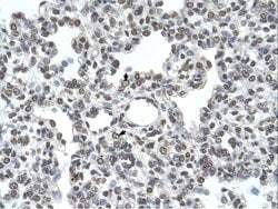 Invitrogen TMPRSS11D Polyclonal Antibody 100 &mu;L; Unconjugated:Antibodies,