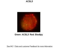 Invitrogen ACSL3 Polyclonal Antibody 100 &mu;L; Unconjugated:Antibodies,