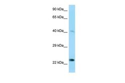 MMP20 Polyclonal Antibody 100 &mu;L | Buy Online | Thermo Scientific | Fisher Scientific