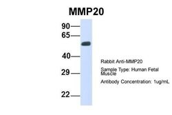 MMP20 Polyclonal Antibody 100 &mu;L | Buy Online | Thermo Scientific | Fisher Scientific