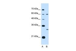 Invitrogen TSPAN32 Polyclonal Antibody 100 &mu;L; Unconjugated:Antibodies,
