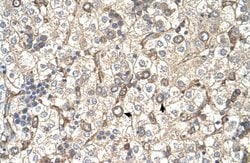Invitrogen ST3GAL4 Polyclonal Antibody 100 &mu;L; Unconjugated:Antibodies,