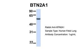 Invitrogen BTN2A1 Polyclonal Antibody 100 &mu;L; Unconjugated:Antibodies,