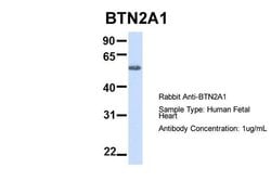 Invitrogen BTN2A1 Polyclonal Antibody 100 &mu;L; Unconjugated:Antibodies,