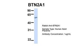 Invitrogen BTN2A1 Polyclonal Antibody 100 &mu;L; Unconjugated:Antibodies,