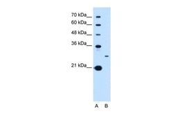 Invitrogen TSPAN15 Polyclonal Antibody 100 &mu;L; Unconjugated:Antibodies,
