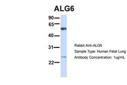 Invitrogen ALG6 Polyclonal Antibody 100 &mu;L; Unconjugated:Antibodies,
