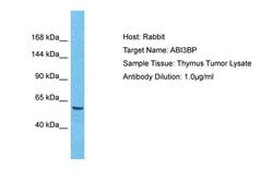 Invitrogen ABI3BP Polyclonal Antibody 100 &mu;L; Unconjugated:Antibodies,
