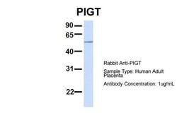 Invitrogen PIGT Polyclonal Antibody 100 &mu;L; Unconjugated:Antibodies,