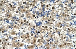 Invitrogen GDE1 Polyclonal Antibody 100 &mu;L; Unconjugated:Antibodies,