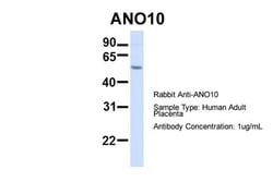 Invitrogen TMEM16K Polyclonal Antibody 100 &mu;L; Unconjugated:Antibodies,