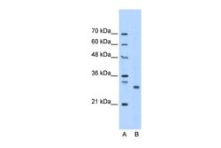 Invitrogen PSMC3IP Polyclonal Antibody 100 &mu;L; Unconjugated:Antibodies,