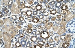 Invitrogen ST14 Polyclonal Antibody 100 &mu;L; Unconjugated:Antibodies,