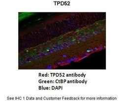 Invitrogen TPD52 Polyclonal Antibody 100 &mu;L; Unconjugated:Antibodies,