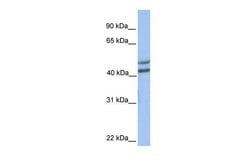 Invitrogen GALT Polyclonal Antibody 100 &mu;L; Unconjugated:Antibodies,