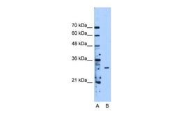 Invitrogen METTL1 Polyclonal Antibody 100 &mu;L; Unconjugated:Antibodies,
